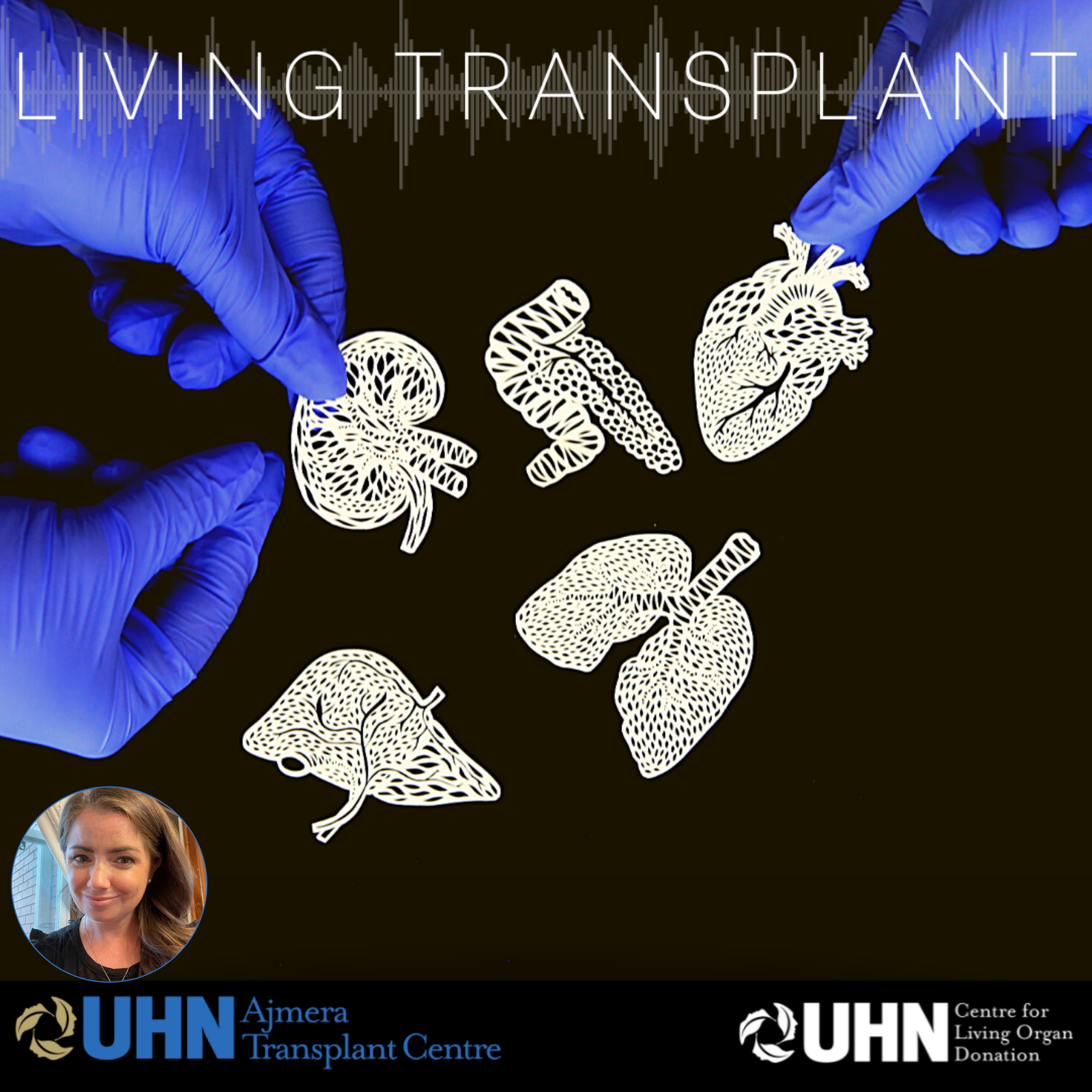 Living Transplant: Patient Stories | Organ Donation | Medical Experts